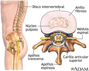 Cada disco intervertebral se compone de núcleo pulposo y anillo fibroso