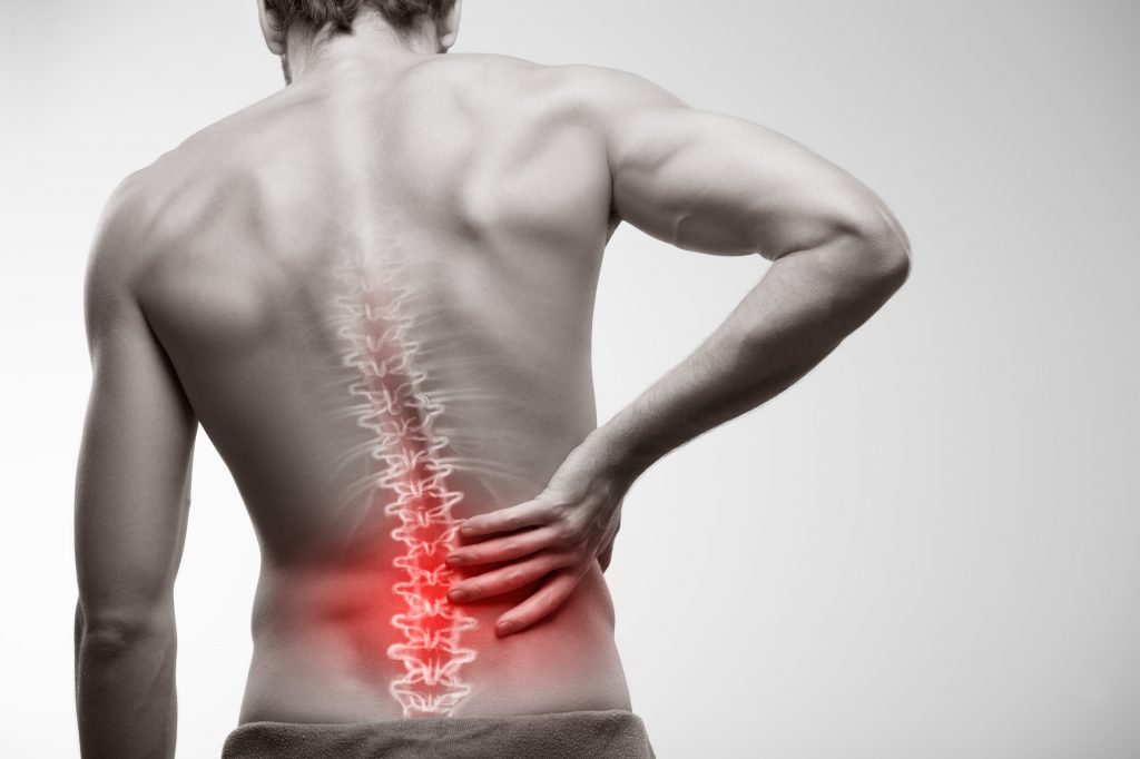 Lesiones de disco: degeneración con osteofitos