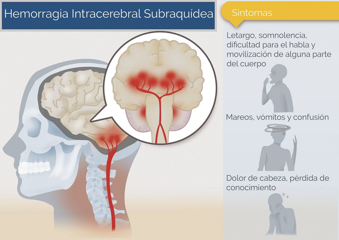 Hemorragia Interna: O Que É, Sintomas, Causas E Tratamento – IDOCTJ