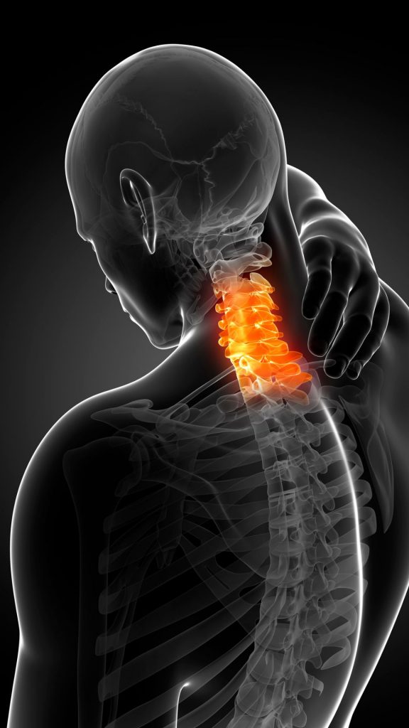 Dolor cervical: Causas, síntomas y tratamiento