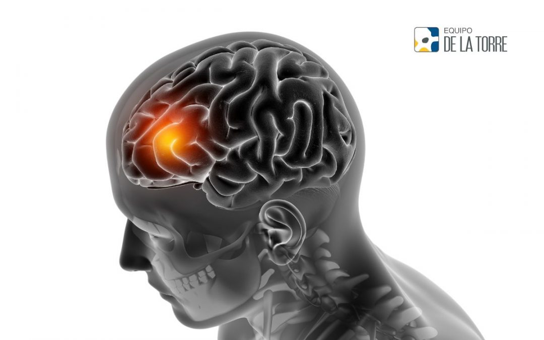 Tumor Cerebral: Tipos, Causas y tratamientos